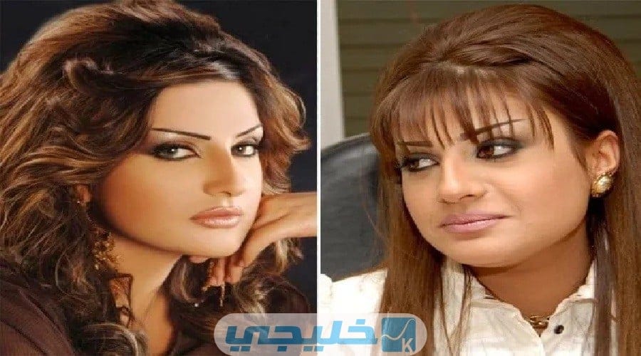 أمل العوضي قبل وبعد عمليات التجميل بالصور وأهم المعلومات عنها
