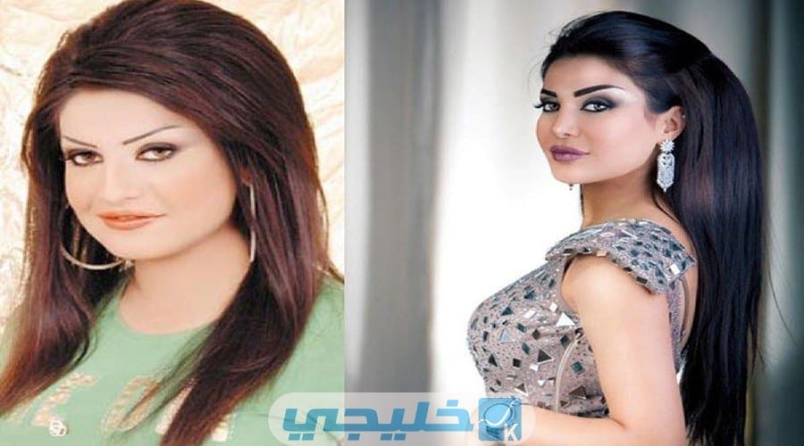 أمل العوضي قبل وبعد عمليات التجميل بالصور وأهم المعلومات عنها