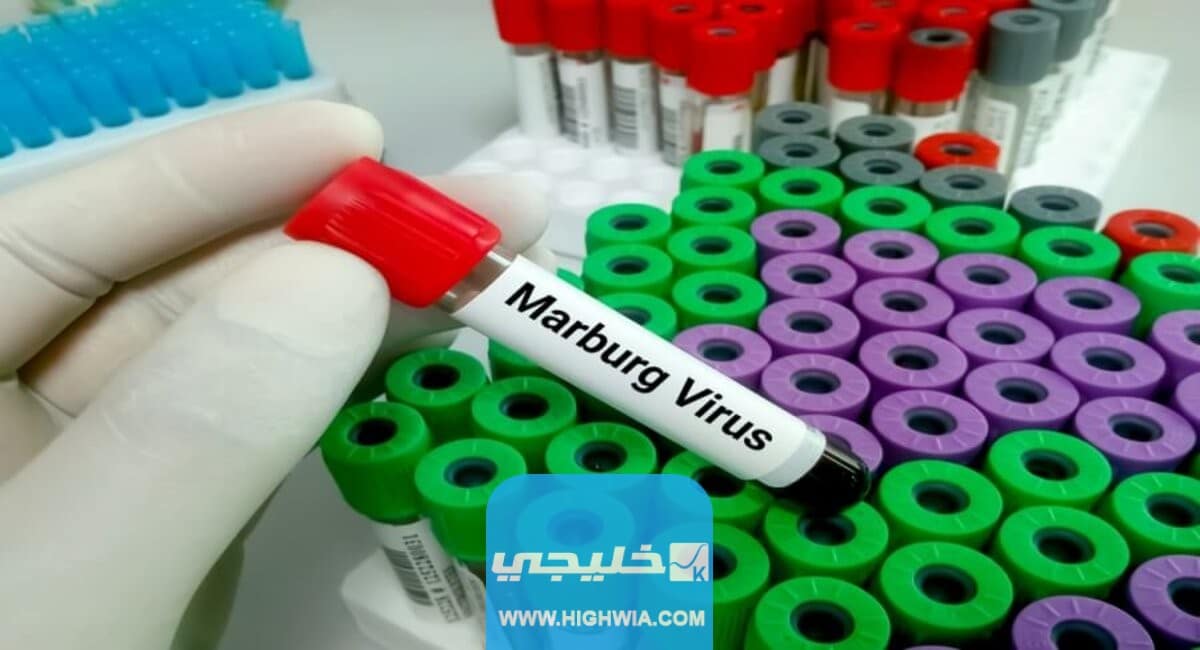كيف تتم العدوى بفيروس ماربورغ