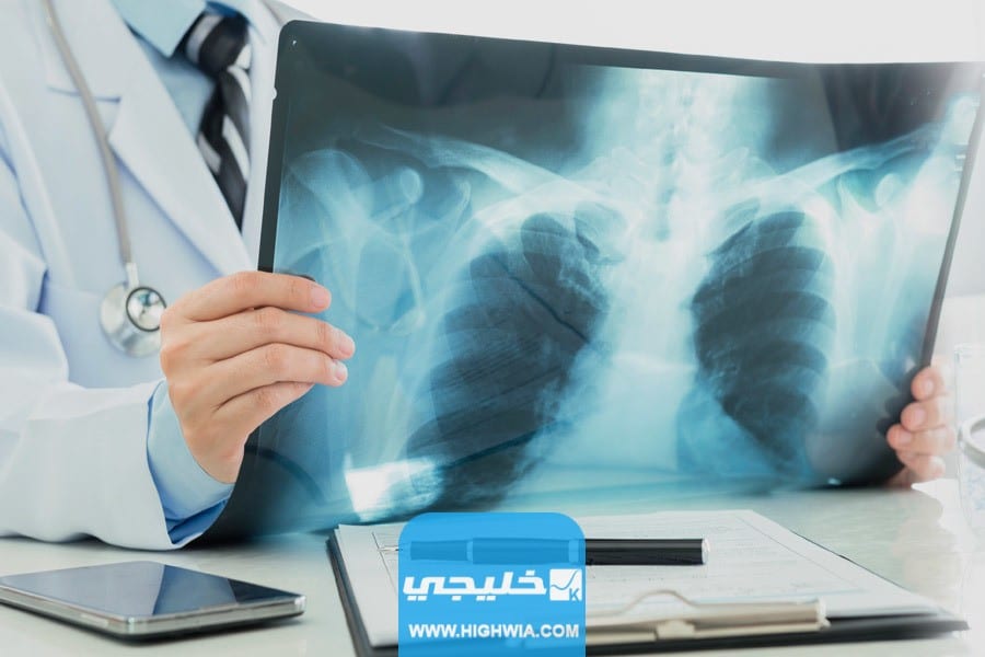 راتب أخصائي أشعة في السعودية 2023