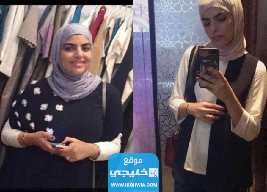 صور نجلاء الودعاني قبل وبعد التكميم والتجميل