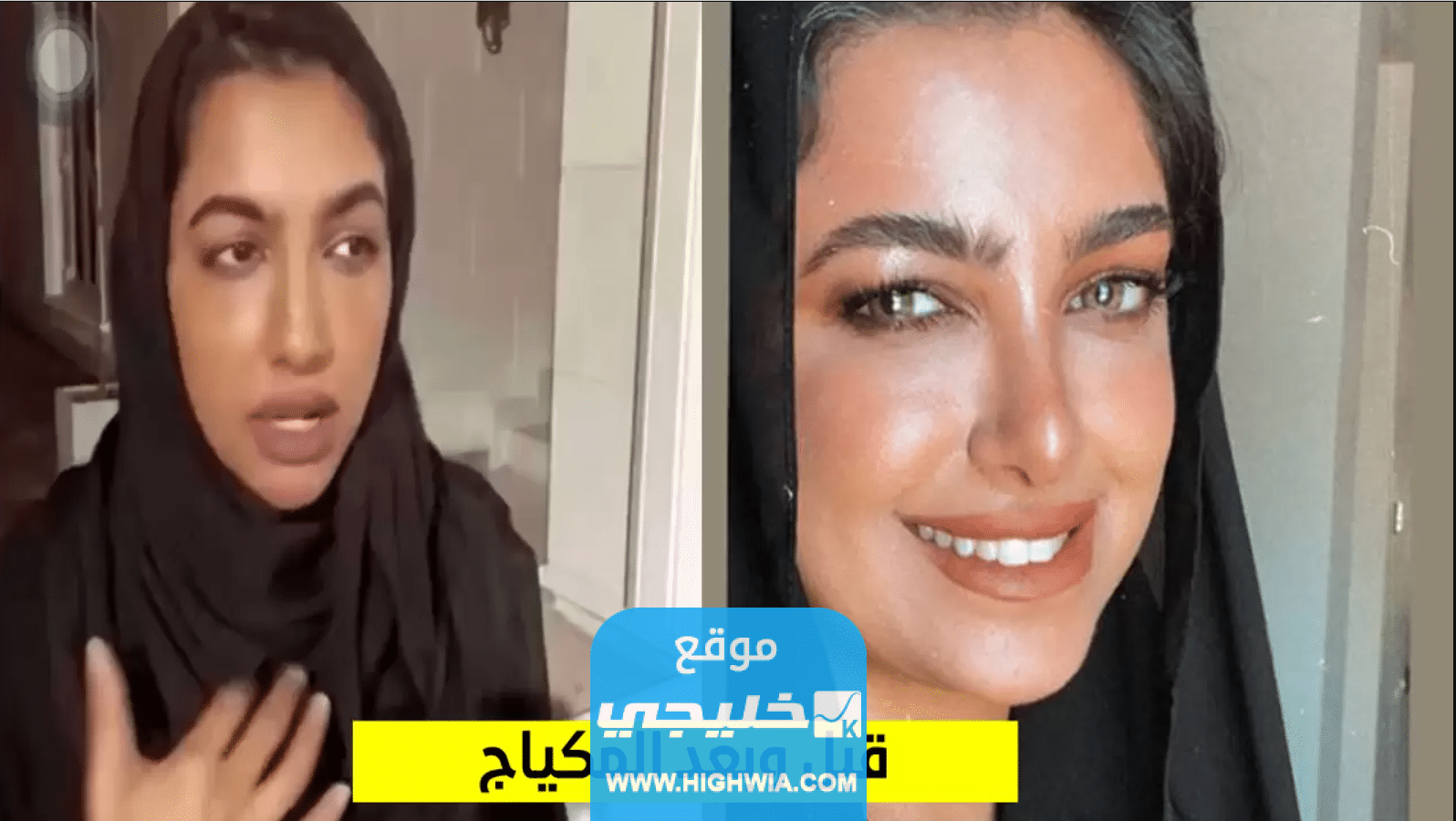 صور نجلاء الودعاني قبل وبعد التكميم والتجميل