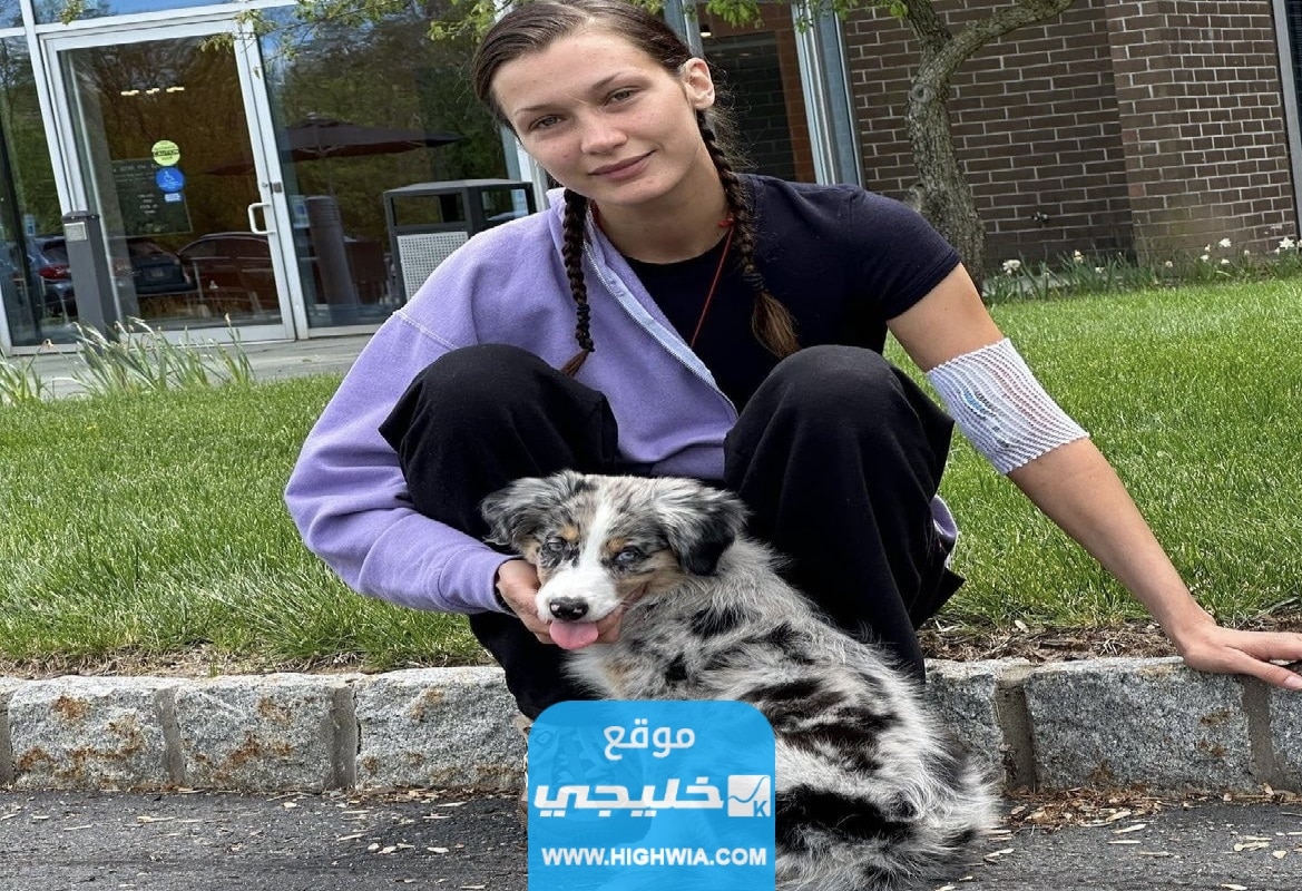 ما هو مرض بيلا حديد؟!.. تفاصيل حالتها الصحية