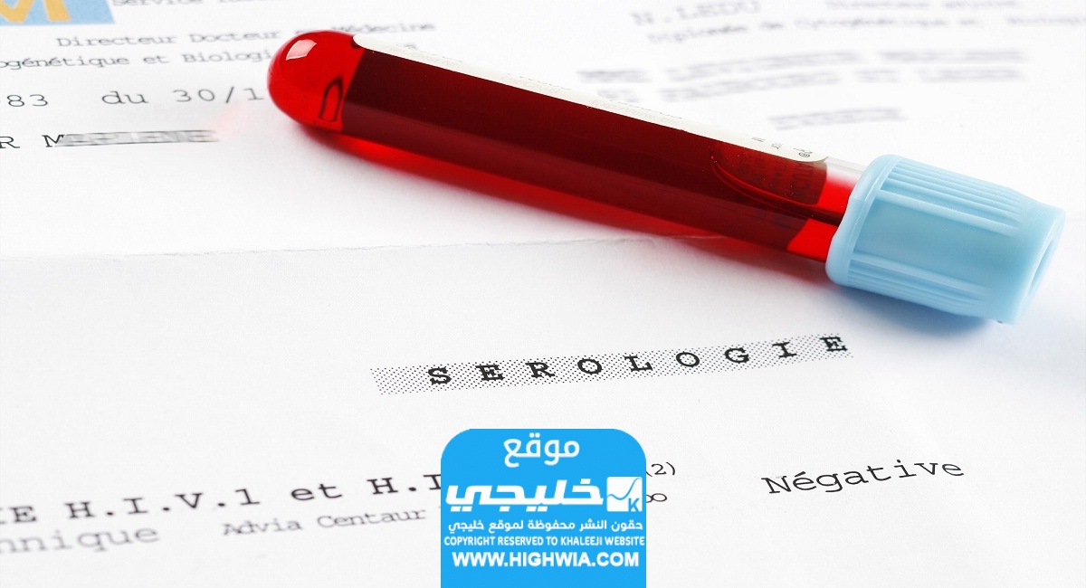 كم سعر تحليل الايدز في السعودية 2023/1445