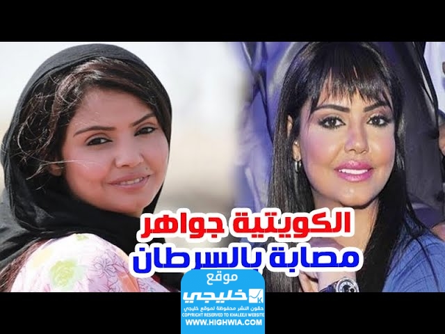 سبب وفاة الفنانة جواهر الكويتية