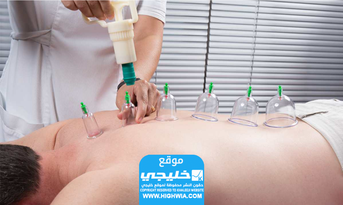 افضل ايام الحجامة لشهر يناير 2024