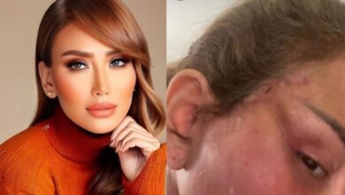 صور ريهام سعيد قبل وبعد عملية التجميل