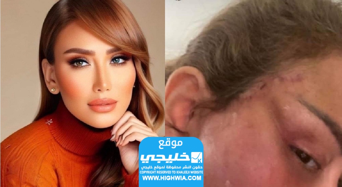 صور ريهام سعيد قبل وبعد عملية التجميل