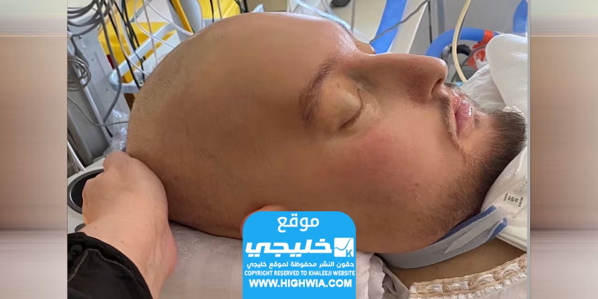 سبب غيبوبة الوليد بن خالد