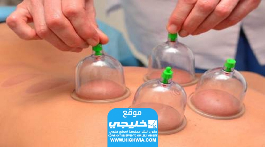 افضل مواعيد الحجامة لشهر يونيو 2024