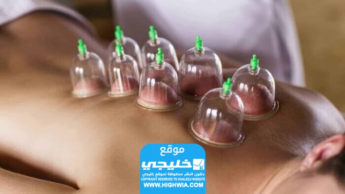 أفضل مواعيد الحجامة في شهر أغسطس