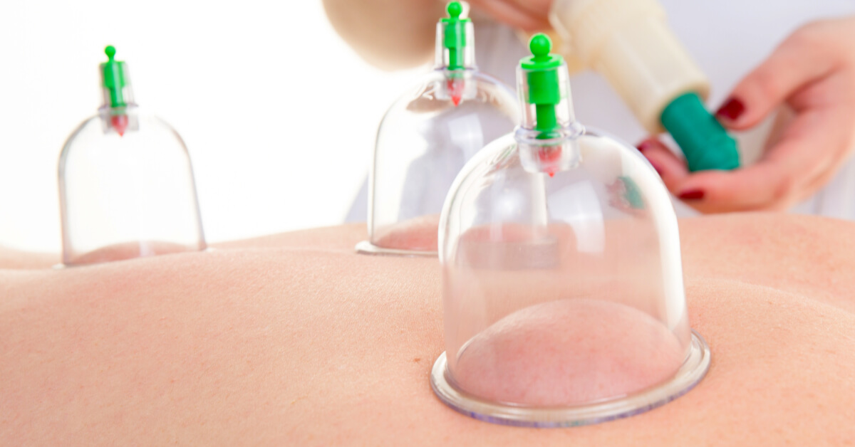 افضل مواعيد الحجامة لشهر سبتمبر